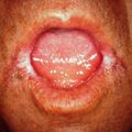 misuse_steroid2000-295.jpg
