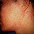 misuse_steroid2000-303.jpg