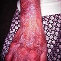 misuse_steroid2000-97.jpg