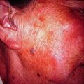misuse_steroid2000-98.jpg