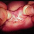 misuse_steroid9-1079.jpg