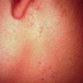 misuse_steroid9-273.jpg