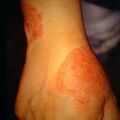 misuse_steroid9-294.jpg