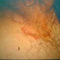 misuse_steroid9-541.jpg