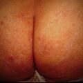 misuse_steroid9-562.jpg