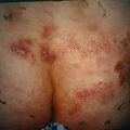 misuse_steroid9-686.jpg