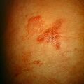 misuse_steroid9-687.jpg