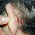 misuse_stimoline011224.jpg