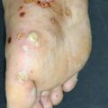 misuse_sulphur010827.jpg