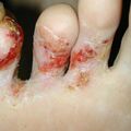 misuse_tanasil010731-2.jpg