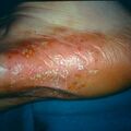 misuse_tanasil9-624.jpg