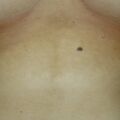 misuse_tarimazole020907.jpg