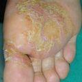 misuse_terbina020812.jpg