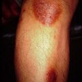 misuse_terbina2000-257.jpg