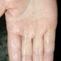 misuse_terbinafine020820-2.jpg