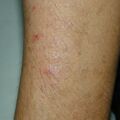 misuse_terramycin010802.jpg