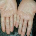 misuse_terramycin020813-1.jpg