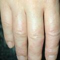 misuse_terramycin020813-3.jpg