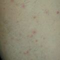 misuse_thioglycollicacid020830-1.jpg