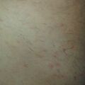 misuse_thioglycollicacid020830-2.jpg