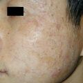 misuse_tigerbalm010406.jpg