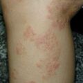 misuse_tigerbalm010628.jpg