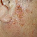 misuse_tigerbalm010712.jpg