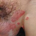 misuse_tigerbalm020816-2.jpg