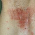 misuse_tigerbalm020816-4.jpg