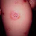 misuse_titibe2000-278.jpg