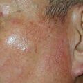 misuse_tolloid_hyde020729-2.jpg