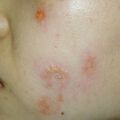 misuse_topical010322-2.jpg