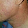 misuse_topical010507.jpg