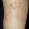 misuse_topical020619.jpg
