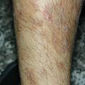 misuse_topical020813-1.jpg