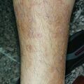 misuse_topical020813-2.jpg