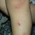 misuse_topical020829-1.jpg