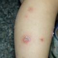 misuse_topical020829-3.jpg