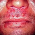 misuse_topical2000-100.jpg