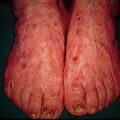 misuse_topical9-1012.jpg