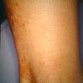 misuse_topical9-356.jpg