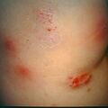 misuse_topical9-394.jpg