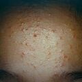 misuse_topical9-438.jpg