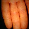 misuse_topical9-594.jpg