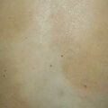 misuse_topicals010620-3.jpg