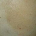 misuse_topicals010620-4.jpg