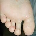 misuse_tricort020625.jpg