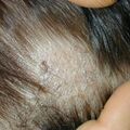 misuse_trinazoleg020207-1.jpg