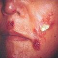 misuse_ttum9-224.jpg