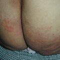 misuse_uracin020722.jpg